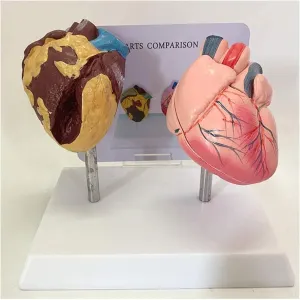 and Normal overcome warehouse Heart Comparison Model, Medical Anatomy Heart Model, for Learning, Display and Teaching Medicine Human Organ Anatomy Model Heart Model, Smoking Heart 